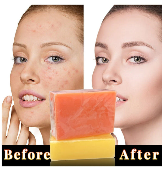 Your Ultimate Solution for Anti-Aging, Acne, and Dark Spots